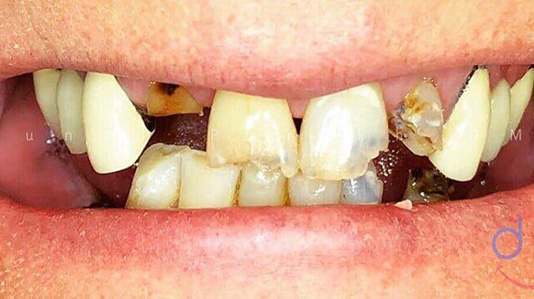 Dental Procedure Before Photo