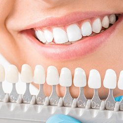 computer model of dental bridges and a crown