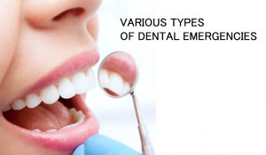 types of dental emergencies poster