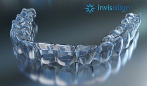 invisalign clear tooth aligners