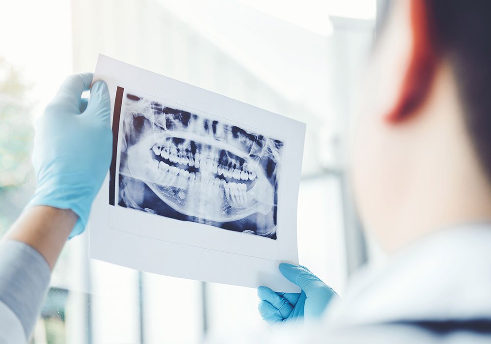 philadelphia dentist model looking at patient x-rays