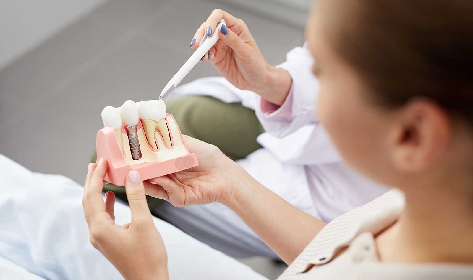 philadelphia dentist office dental implants tooth model
