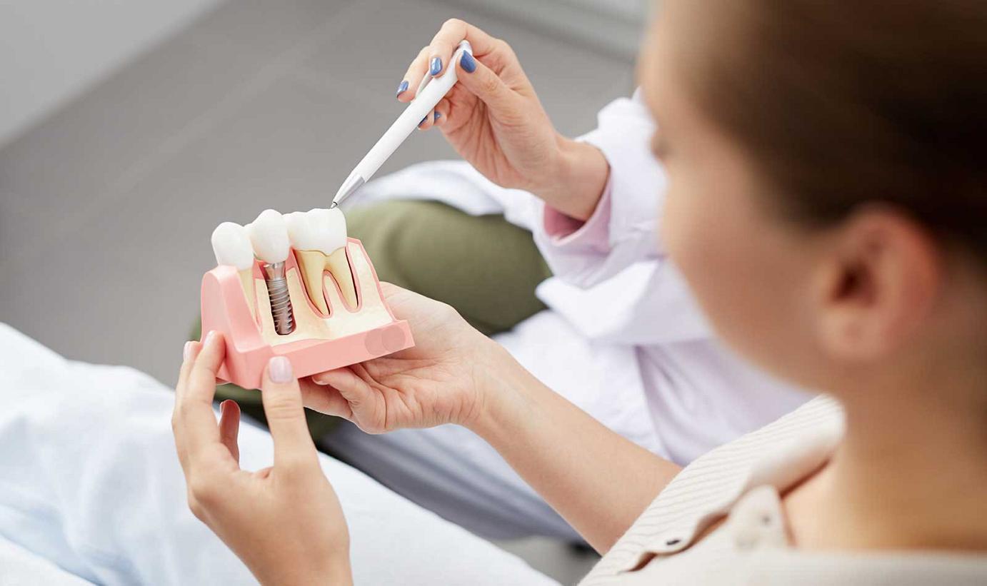 Read more about the article Are You a Good Candidate for Dental Implants?